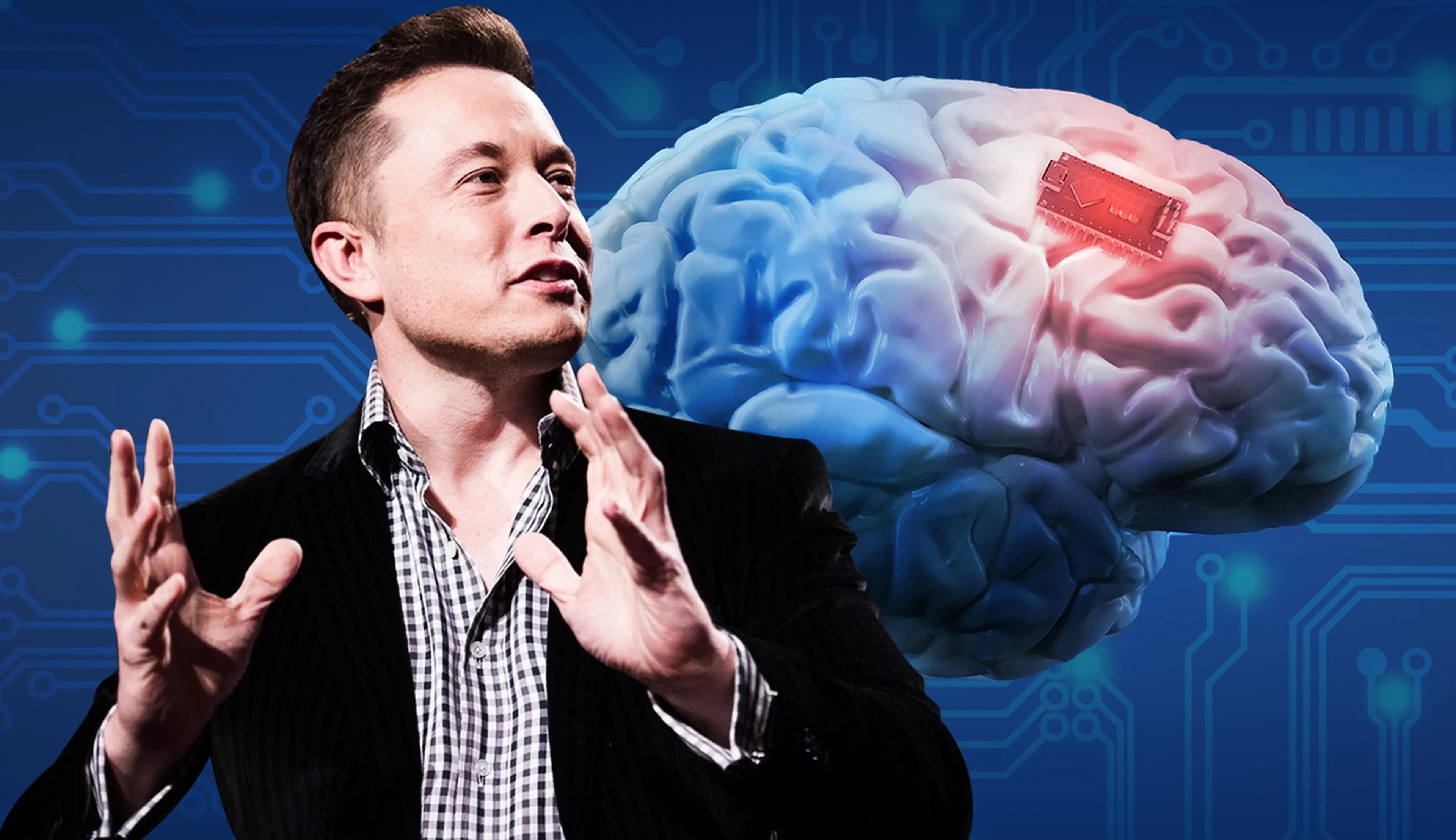 马斯克脑机接口公司 Neuralink 正寻找人体试验合作伙伴
